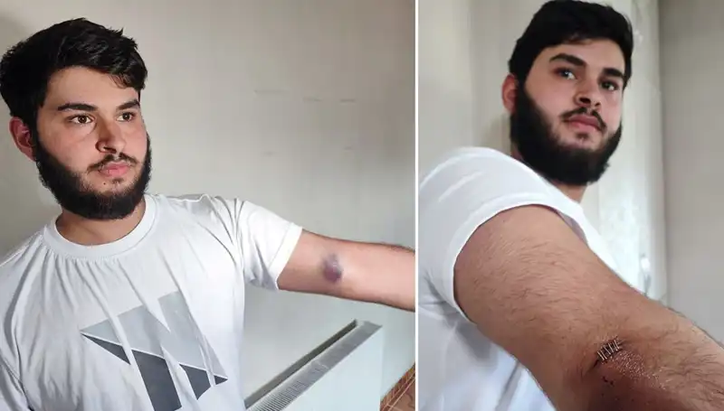 Bahçeye Kaçan Top, Mahallede Kaos Yaratırken "Conolar Kamyonetle Geldi" İddiası Gündem Oldu
