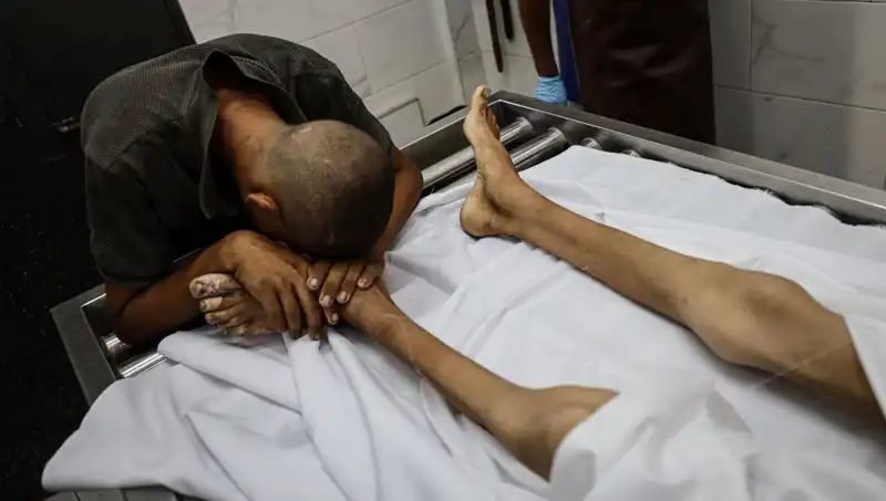 Gazze'de Açlık Tehlikesi: Bir Çocuğun Hayatı Sona Erdi